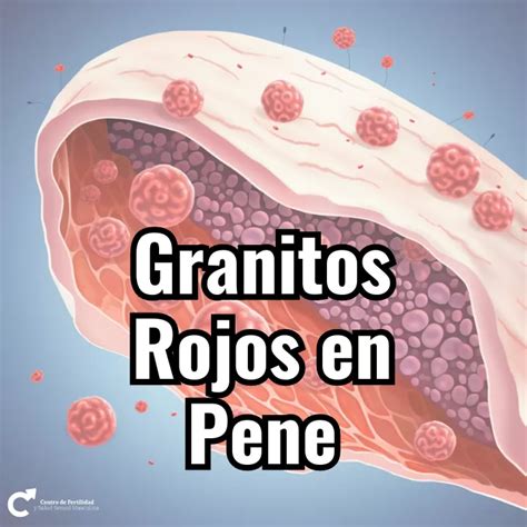 granitos en el oene|Ampollas en el pene: 5 causas (y qué hacer)